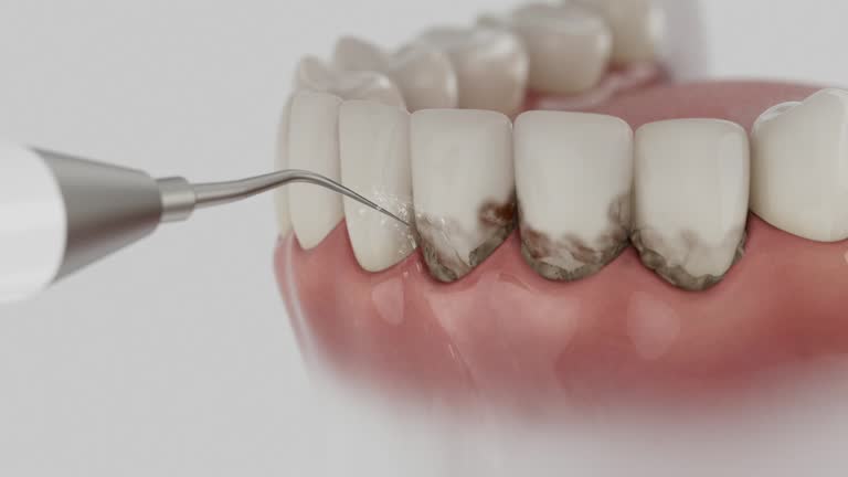 Trusted Wisdom Tooth Removal service in Johnson Creek, WI - Dentist Open Now